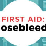 First Aid Nose Bleeds