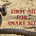 First Aid Snake Bite